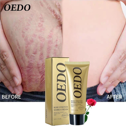 Rose Remove Stretch Marks Cream Repair